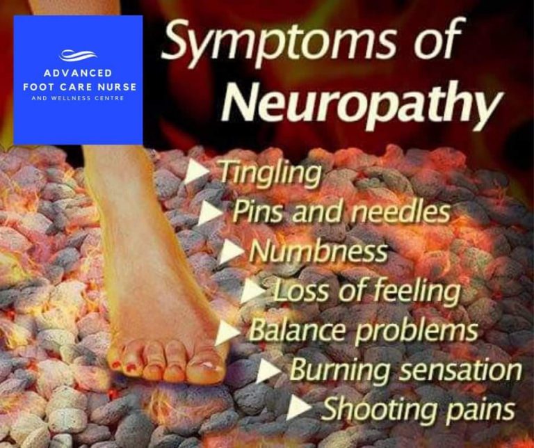 Diabetic Neuropathy - Advanced Foot Care Nurse and Wellness | Foot Care ...