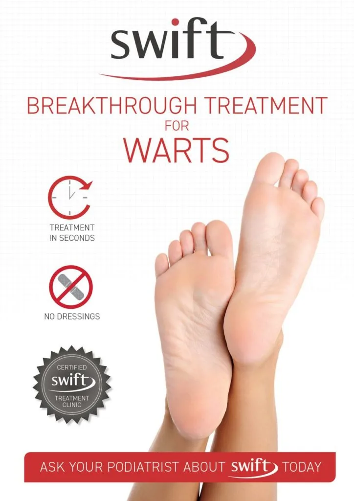 Swift Away Those Stubborn Warts With Microwave Therapy