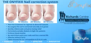 Onyfix nail picture W