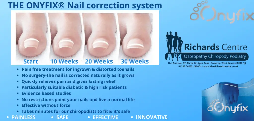 Onyfix nail picture W